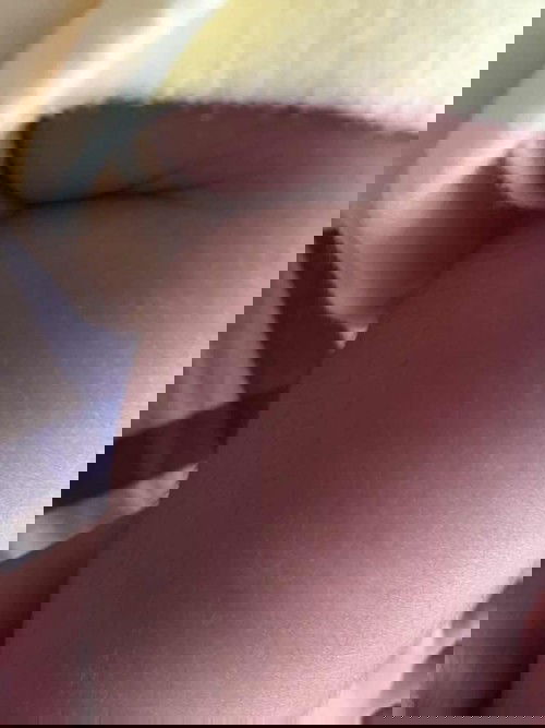 Bayi perempuan berbulu