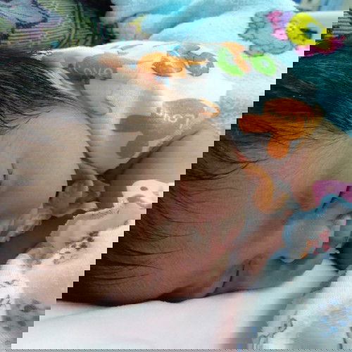 เด็กเกินกำหนดคลอด