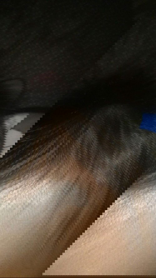 Kepala benjol kaya berisi air waktu jatuh dari kasur