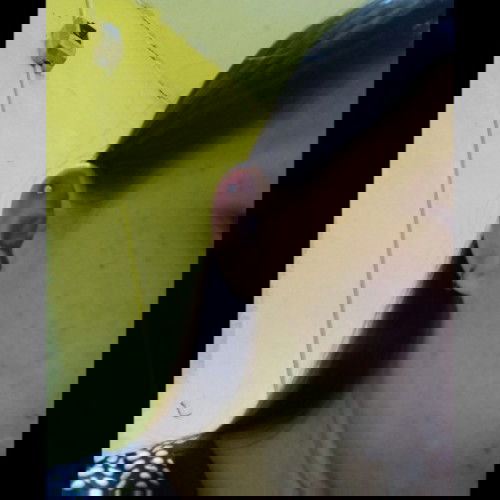 Red Spots on my face