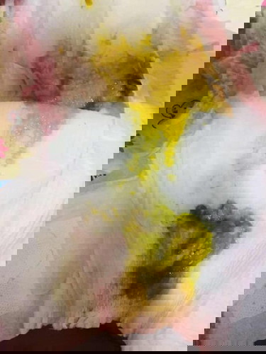 Ano po ibig sabihin nito? 😖😖😫 tulong please. 4 months na po baby ko.