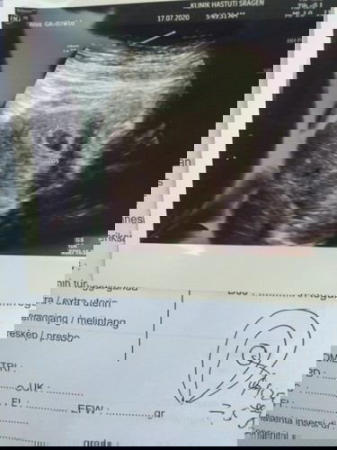 Tolong bantu jawab ya bunda...