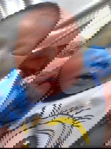 ขอถามคุณแม่ที่ลูกตัวเคยเหลืองหรือยังเหลืองยู่นะคะ