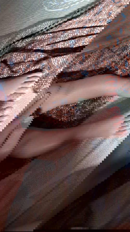 Bentuk Kaki O pd bayiku