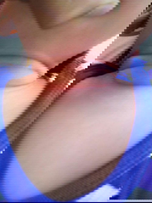 ลูกคอเเดงแบบนี้ใช้อะไรถึงหายคะ