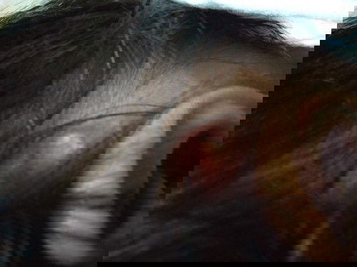 Bisul di belakang kuping