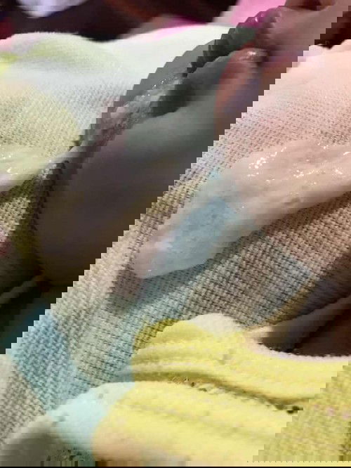 หายใจครืดคราด