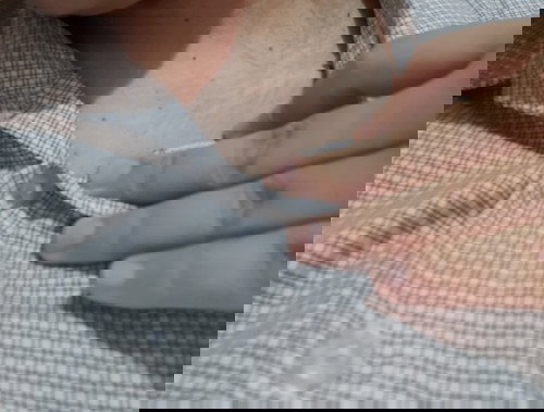 muncul bintik hitam pada leher