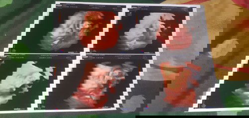 Berat 2 kilo di kehamilan 35 week