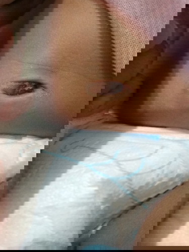 di postinganku sebelumnya merah daging, habis priksa ke bidan di tutup kapas+albothyl, pas sore di lepas jadi item tp masih agak berair, apa seperti ini prosesnya bun?