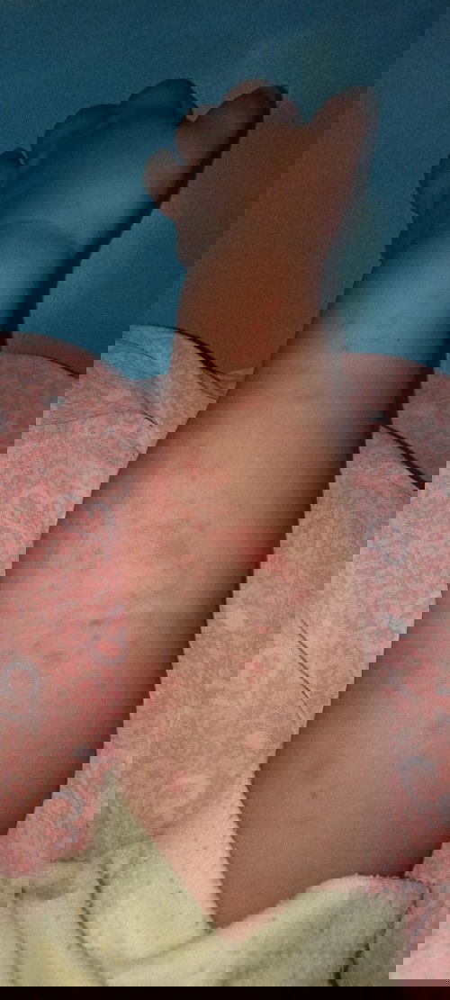 Bantu ya bund cari tau ini kenapa dan obat nya apa ?