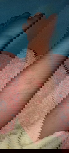 Bantu ya bund cari tau ini kenapa dan obat nya apa ?