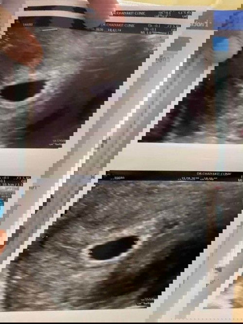 ใครมีประสบการณ์แบบนี้บ้างคะ