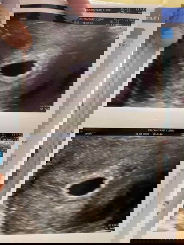 ใครมีประสบการณ์แบบนี้บ้างคะ