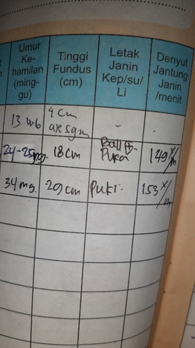 letak janin