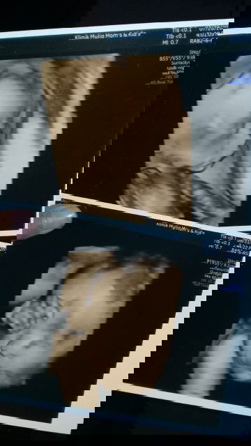 usg 4d begini jelasnya