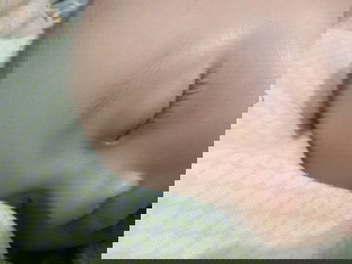 pinggir mata numbuh putih