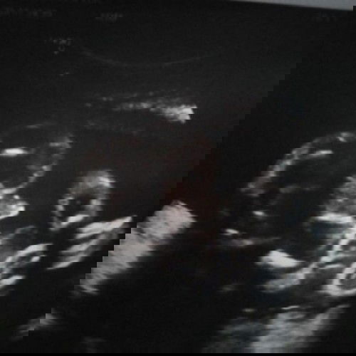 26+3เพศชายคะคลอด4ธันวาคะ