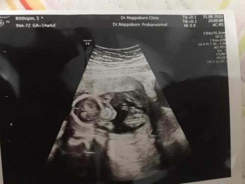 คุณแม่บ้านไหนดูออกบ้างจ้ะ