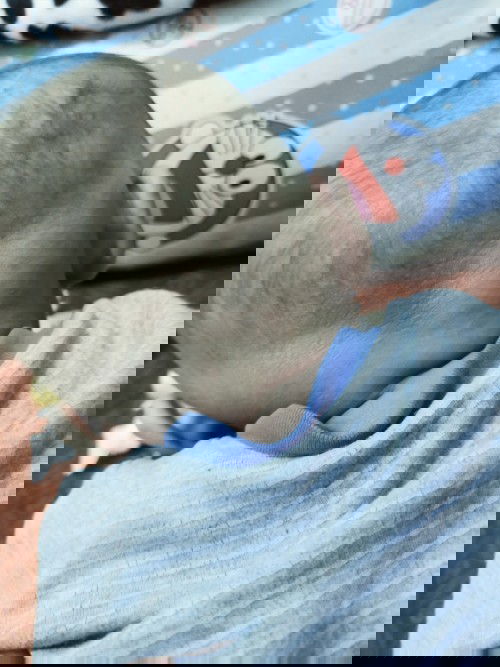 Kulit kepala belakang kering