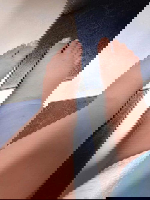 เท้าบวม เสี่ยงครรภ์เป็นพิษ