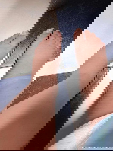 เท้าบวม เสี่ยงครรภ์เป็นพิษ