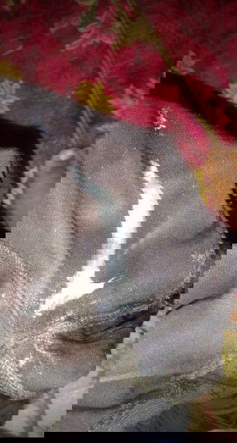 39+5แล้วค่ะเป้นแบบนี้ควรทำอย่างไรค่ะ