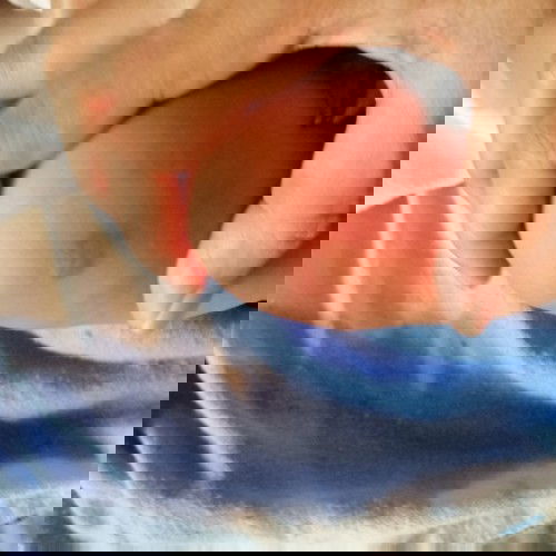 Ano  po kaya to? #1st time mom