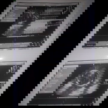 CARA BACA HASIL USG BAGAIMANA