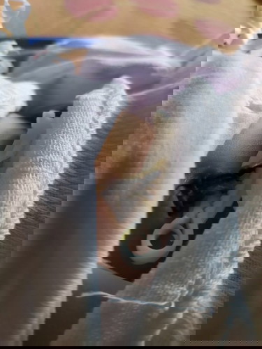 Taking care of umbilical