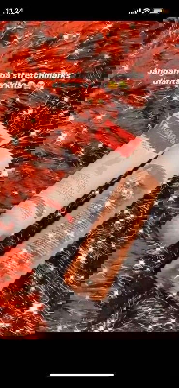 NO STRETCHMARK🙅🏻‍♀️