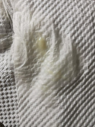 32weeks, vaginal discharge