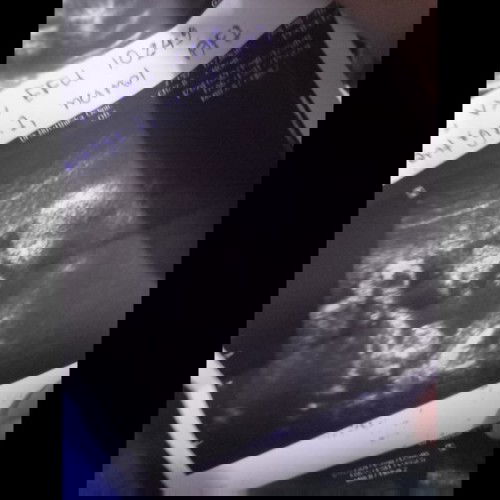 ทีมคลอดเดือนพฤศจิกา ตอนนี้27w1dเพศชายคับ