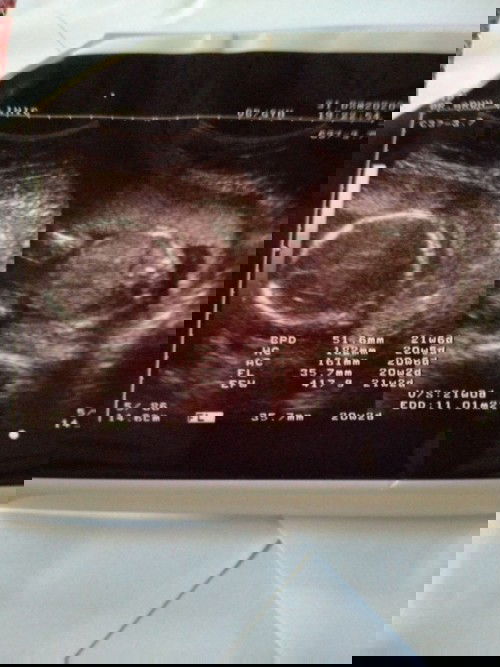 ช่วยดูรูปให้หน่อยค่ะ