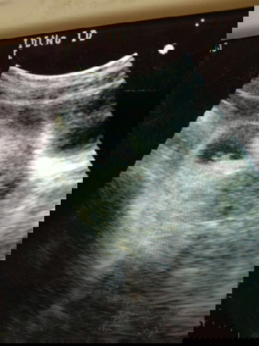 ซาว 7w ท้องสองจ้าา