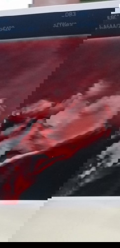 3D ULTRASOUND