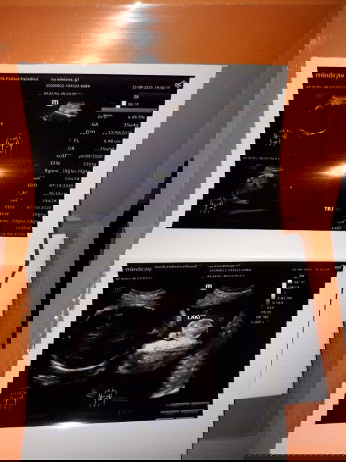 Hpl 20 september 2020