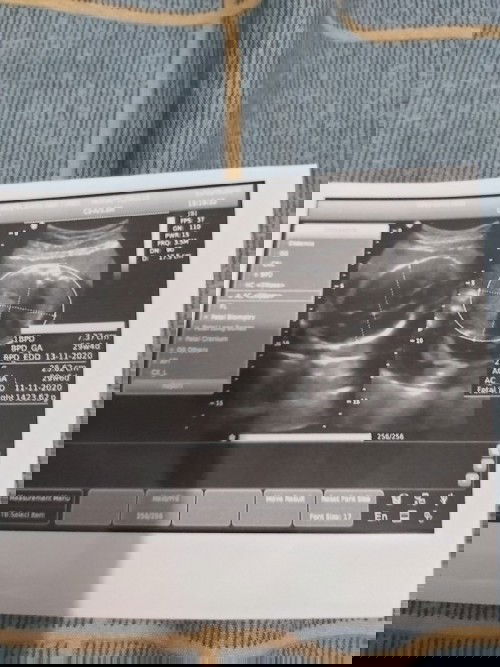 Hamil ke 3 semoga lancar tanpa suatu kekurangan apapun  sampai sang buah hati lahir ke dunia