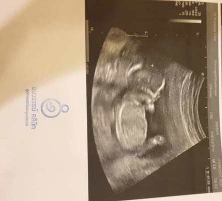 หนูอ้วนมั้ยค้าาา