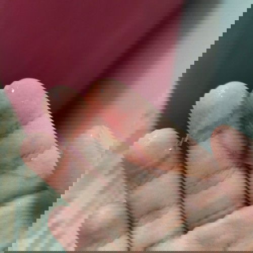 ท้องได้36+6สัปดาห์ แล้วมีใสๆๆออกมาปนเลือด