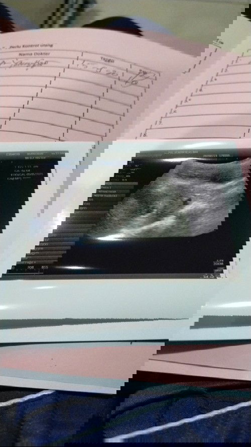 Pendarahan di 6weeks