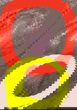 Hemorrhoids at 39 Weeks