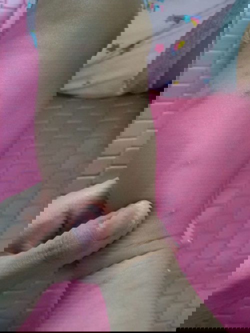 bentol dikaki bayi 5 bulan