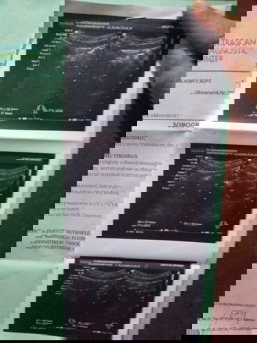 #Looking some expert