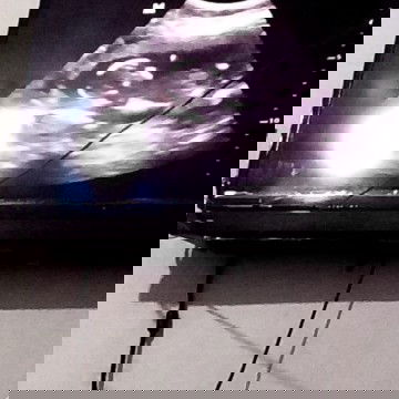 Hasil USG 14w 4d tgl 29 Agustus, pas isi sesuai HPL USG 17-02-2021 kenapa jadi 16 w ya?