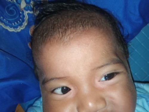 Ini mata nya kenapa yah Bun aku udah 2 kali tanya loh plus jawab lah obat nya gimana??π£π£ Plissssss