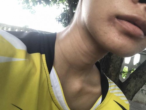 แม่ๆบ้านไหน ขอบปากดำไหมคะ