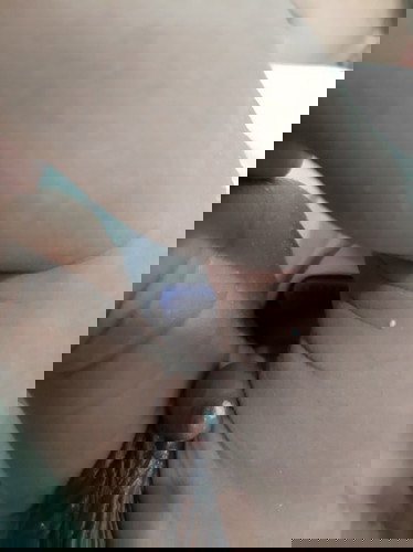 white small pearl like on my baby's penis