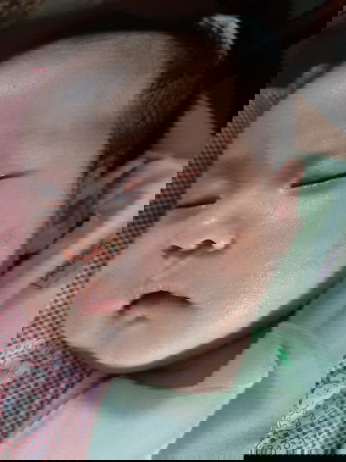 ini Ruam atau Biang Kringat atau apa ya?