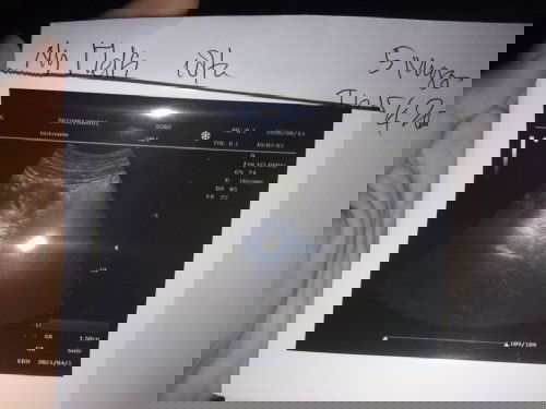 Bingung lupa tanggal